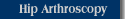 Hip Arthroscopy