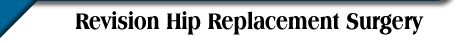 Revision Hip Replacement Surgery